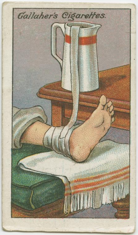 Treat sprain