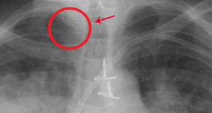 X-ray, horrifying
