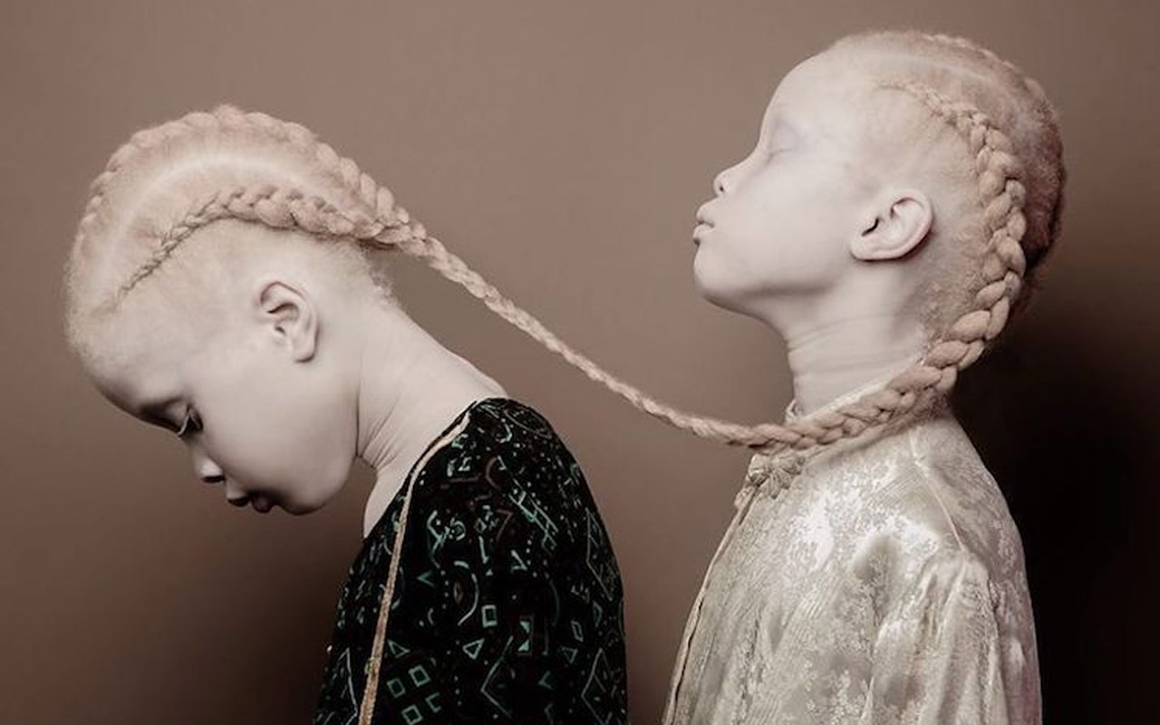  Vinicius Terranova, Photography, Albino, Albinism, beauty