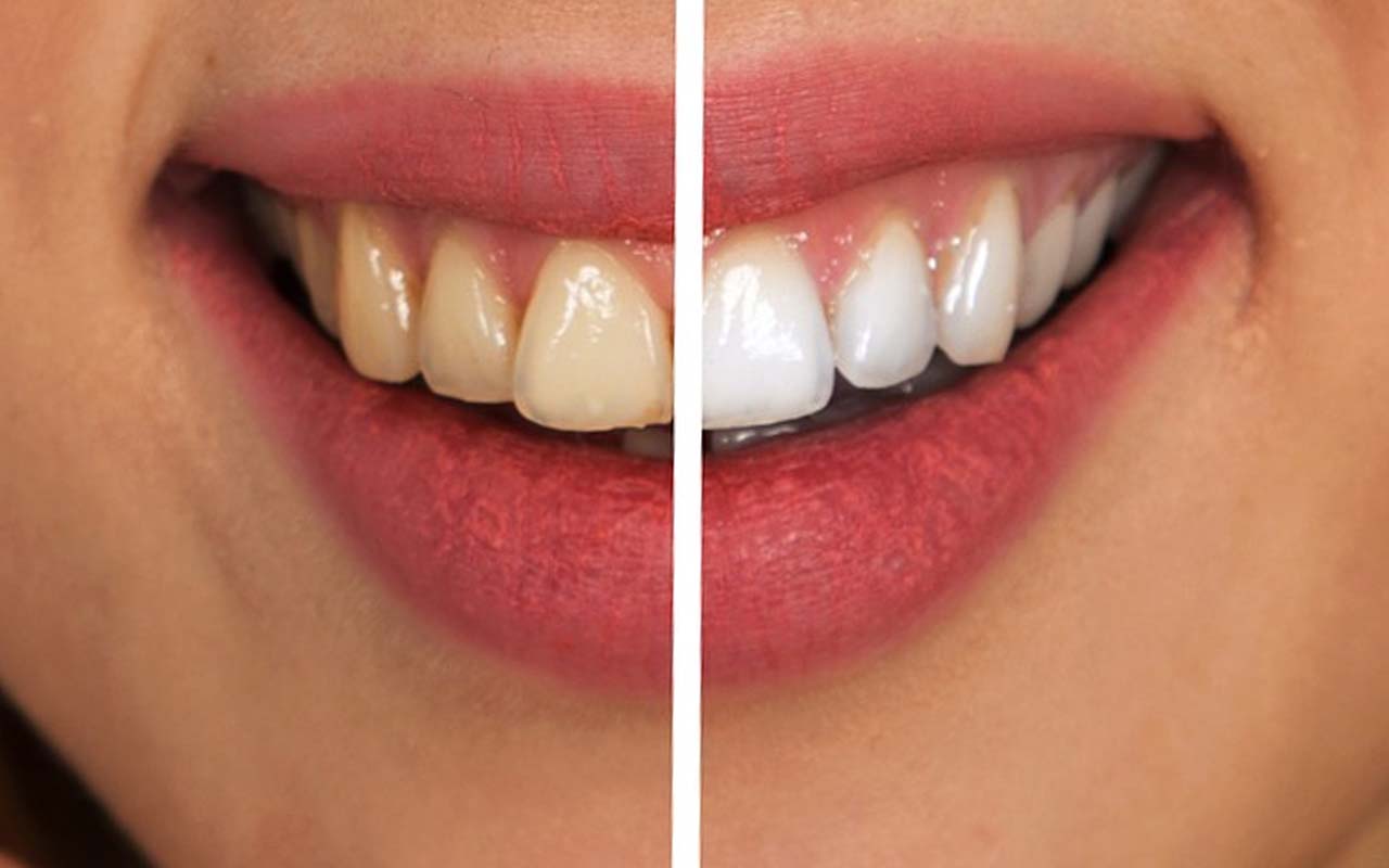 common sense, facts, science, health, teeth, white, yellow, dark, smoking