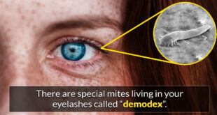 demodex, eyelashes, science, facts, people, own body